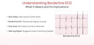 What Does Borderline ECG Mean