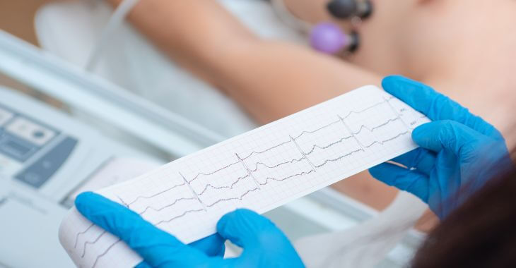 What Does Borderline ECG Mean