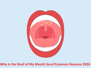 Why Is the Roof of My Mouth Sore? Common Reasons 2026