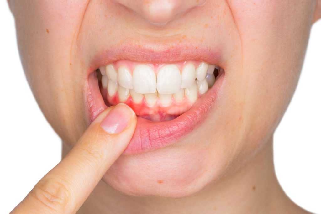 Why Do My Gums Suddenly Hurt and Feel Swollen? 2026