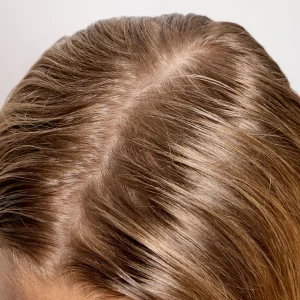 Why Does My Hair Get Greasy After One Day? Hair Care Tips 2026
