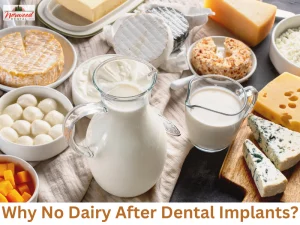 Why No Dairy After Dental Implant? What Dentists Say 2026