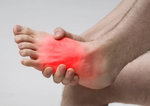 Why Are My Feet Red? Causes and Treatments 2026