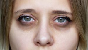 Why Do My Eyes Look Sunken In? Common Causes (2026 Guide)