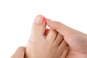 Why Do My Toenails Smell? Signs & Treatment 2026
