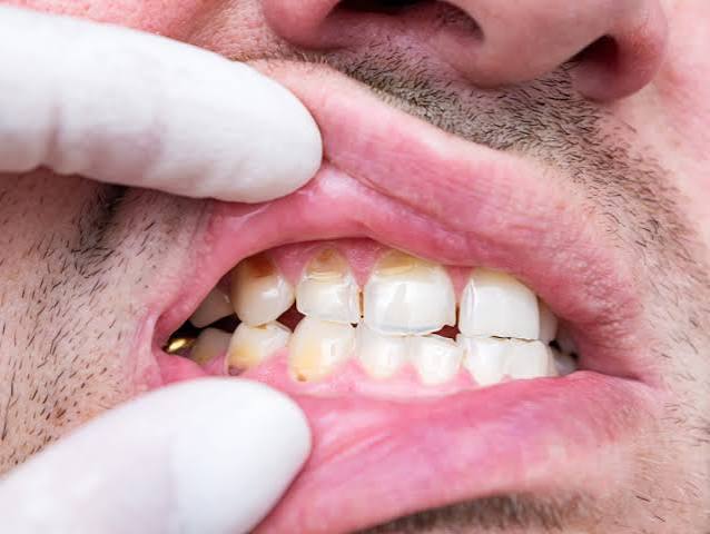 Why Is My Tooth Throbbing? Causes & Relief (2026)