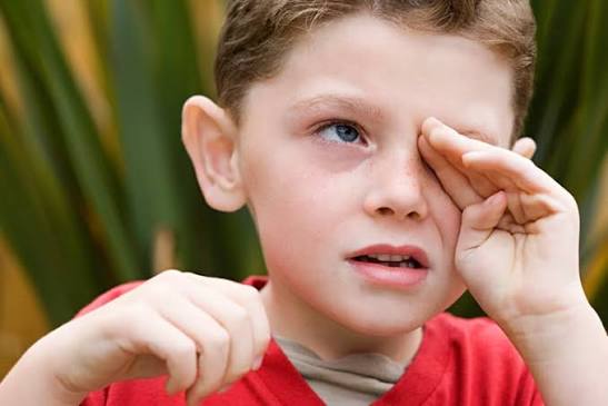 Why Does My Eye Hurt When I Rub It? Causes & Relief 2026