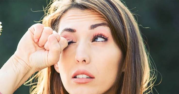 Why Do My Eyes Itch So Much? Causes & Fast Relief 2026