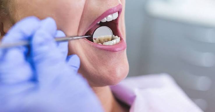 Why Does My Front Tooth Hurt? Causes, Relief, and When to See a Dentist 2026