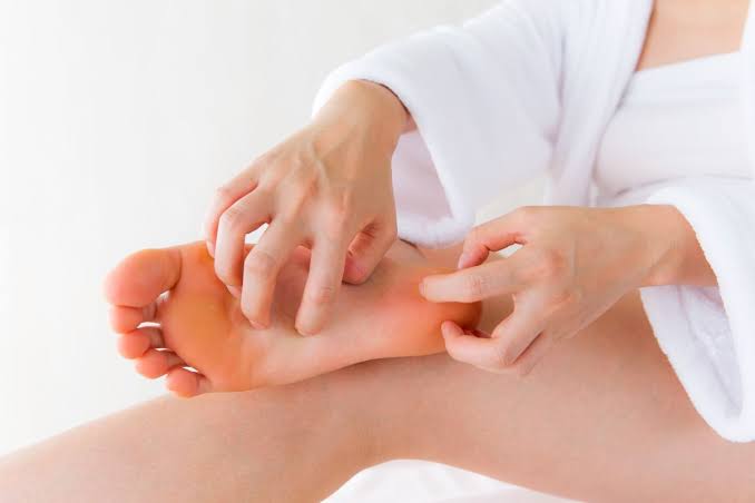 Why Are the Bottom of My Feet Itchy? Causes & Relief 2026