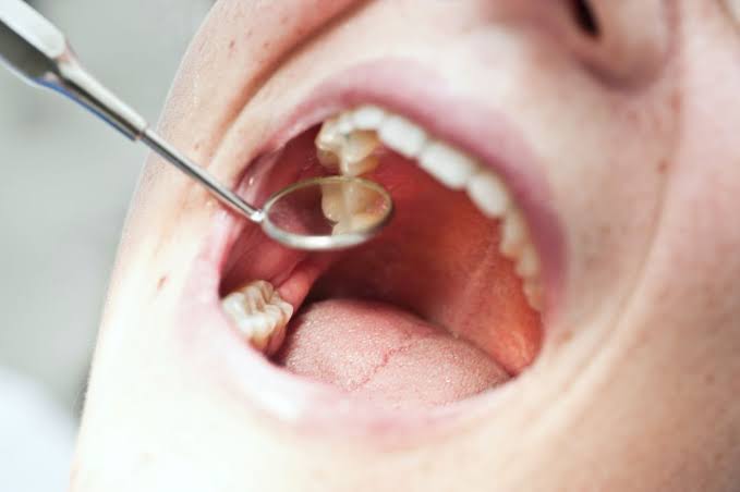 Why Is My Tooth Throbbing? Causes & Relief (2026)
