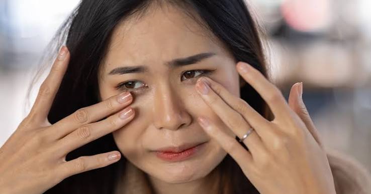 Why Do My Eyes Itch So Much? Causes & Fast Relief 2026