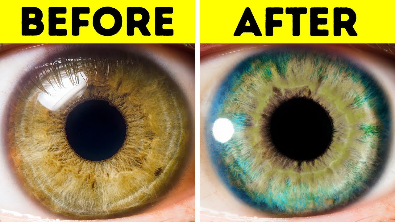 Why Do My Eyes Change Color From Blue to Green? 2026